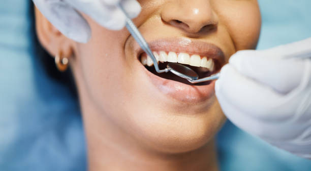 Best Urgent Care for Lost Fillings or Crowns in Pataskala, OH